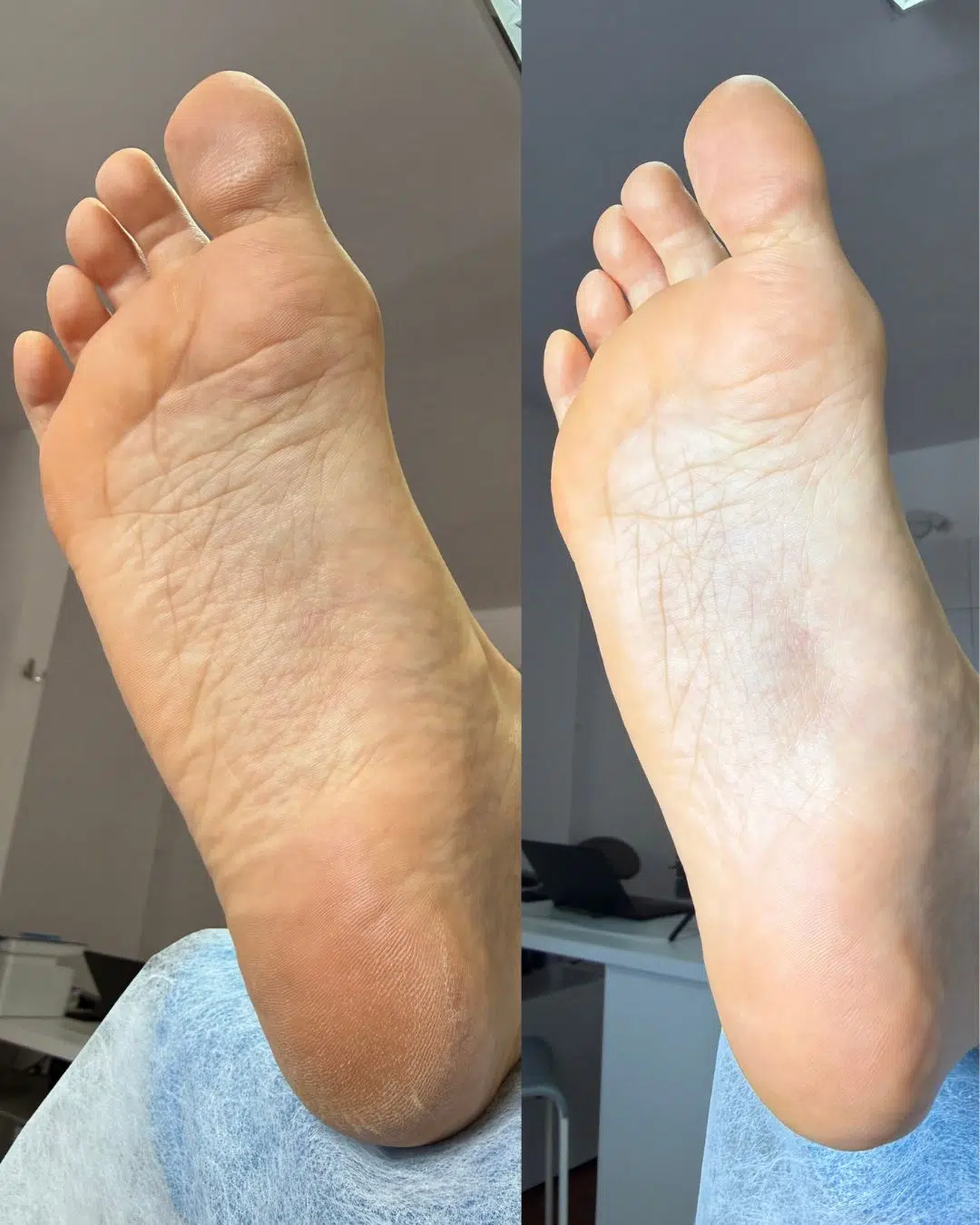 Pedicure podologiczny podstawowy Warszawa Bielany - zadowolona klientka po zabiegu w Gabinecie Na Stopie